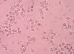 White Blood Cells In Urine Stock Photo