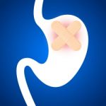 Stomach Ulcers Stock Photo