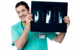 Cheerful Doctor Holding An Thumb X-ray Stock Photo