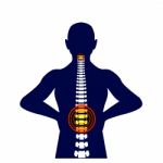 Medical Concept Illustration Of Musculotendinous Strain Back Ache Or Lumbar Pain Stock Photo