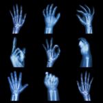 Collection X-ray Of Hands Stock Photo