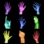 Collection Of Colorful X-ray Hands Stock Photo