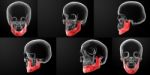 3d Rendering Of Human Skull-upper Half Stock Photo