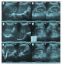 Ultrasonography Image Of Abdomen