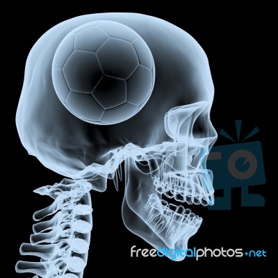 Big Match Never Die, Ball In Head Stock Image
