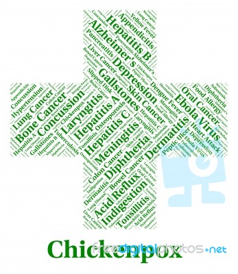 Chickenpox Illness Represents Poor Health And Affliction Stock Image