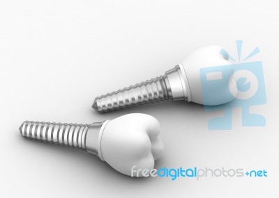 Dental Implantation Stock Image