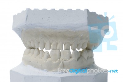 Dental Model Stock Photo