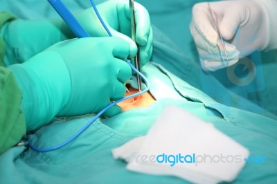 Doctor Using An Electronic Scalpel In A Surgery Stock Photo