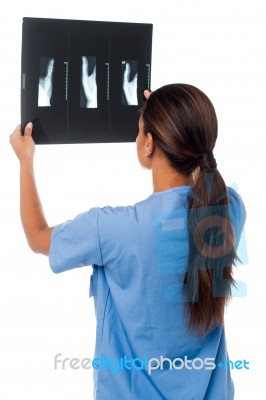 Female Doctor Looking At Patient's X-ray Report Stock Photo