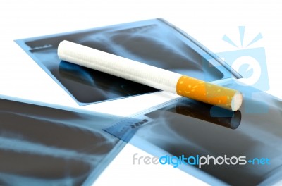 Film X-ray And Cigarette Stock Photo