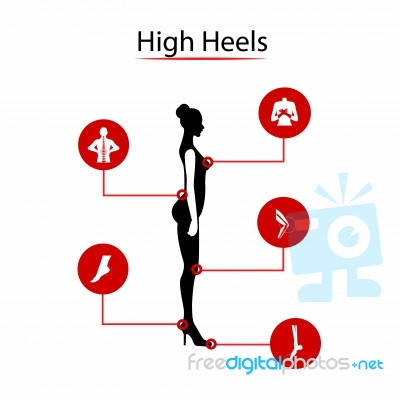 Infografics Woman: High Heels And Our Disease. Illustration Stock Image