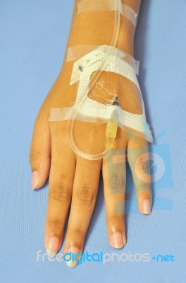 Iv Solution In Patients Hand Stock Photo