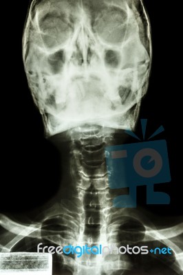 Normal Human's Skull And Cervical Spine Stock Photo