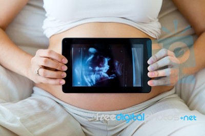 Pregnant Woman Holding Ultrasound Scan On Her Tummy Stock Photo