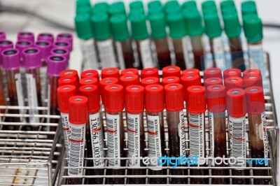 Sample Blood Tubes In Labratory Stock Photo