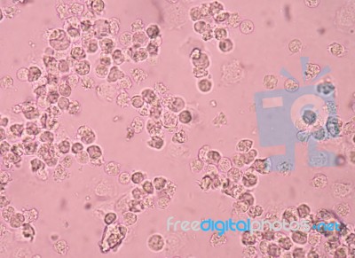 White Blood Cells in Urine Stock Photo