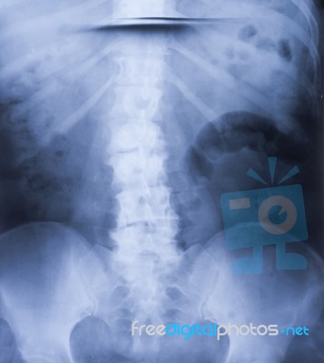 X-ray Stock Photo