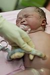 New Born Infant In The Operation Room Stock Photo
