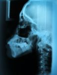 X-ray Skull Stock Photo