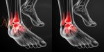 3d Rendering Illustration Of The Ankle Pain Stock Photo