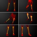 3d Rendering Medical Illustration Of The Tibia Bone Stock Photo