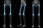 3d Rendering Medical Illustration Of The Femur Bone Stock Photo