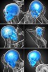 3d Rendering  Medical Illustration Of The Skull Stock Photo