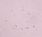 White Blood Cells In Urine Stock Photo