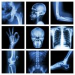 Collection X-ray Part Of Human Stock Photo