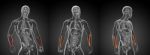 3d Rendering Medical Illustration Of The Radius Bone Stock Photo