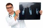 Male Doctor Behind X Ray Report Stock Photo