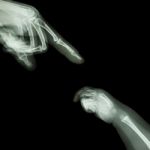 X-ray Adult's Hand Point Finger At Upper Side And Baby's Hand At Lower Side Stock Photo