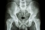 Human's Pelvis And Hip Joints Stock Photo