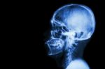 X-ray Asian Skull And Blank Area At Left Side Stock Photo