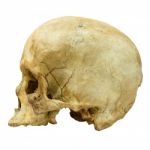 Human Skull Fracture (side)  (mongoloid,asian) On Isolated Background Stock Photo