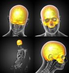 3d Rendering Medical Illustration Of The Upper Skull Stock Photo