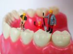 Miniature Worker On Plastic Teeth Of Removable Denture. Dental H Stock Photo