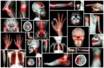 X-ray Multiple Part Of Human With Multiple Disease (stroke, Arthritis, Gout, Rheumatoid, Brain Tumor, Osteoarthritis, Etc) Stock Photo