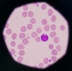 White Blood Cells Stock Photo
