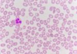 Red Blood Cells With White Blood Cells Background Stock Photo