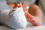 Baby Foot In Bandage And Cast Stock Photo