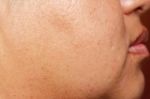 Human Skin Texture Stock Photo