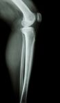 Normal Human's Knee&leg Stock Photo