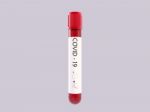 3d Illustration Of A Covid 19 Blood Sample Tube  Stock Photo