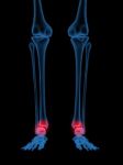 X-Ray Of Human Ankle Stock Photo