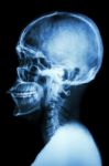 X-ray Asian Skull And Cervical Spine Stock Photo