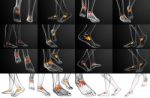 3d Rendering Medical Illustration Of The Midfoot Bone Stock Photo