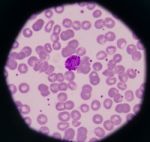 White Blood Cells Stock Photo