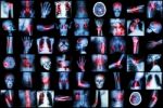 X-ray Multiple Disease Of Child And Adult ( Stroke , Arthritis , Fracture , Tuberculosis , Brain Tumor , Bowel Obstruction  , Kidney Stone , Spondylosis , Spondylolisthesis , Osteoarthritis Knee ,etc) Stock Photo